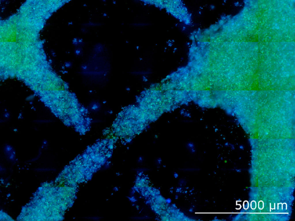 Growing a culture of wood-like cells from zinnia leaves - close-up image