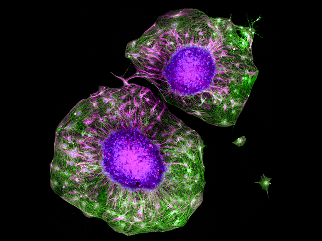 Bright green and purple splatters, motor neurons (in purple) exhibit new growth (in green) faster than neurons that experience no exercise-induced cues. 