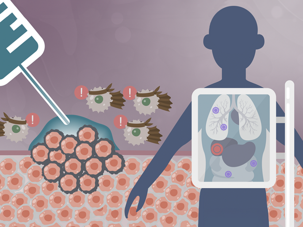 An illustration of an X-ray machine showing the organs inside a silhouette of a body. In the background, a syringe injects gel into a tumor. Immune cells, drawn with exclamation point icons and ninja headbands, swarm the tumor.