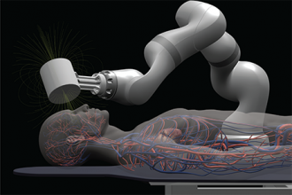 Joystick-operated robot could help surgeons treat stroke remotely